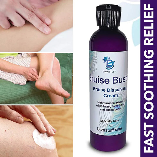 Bruise Busting Treatment Cream, For Those Who Bruise Easily